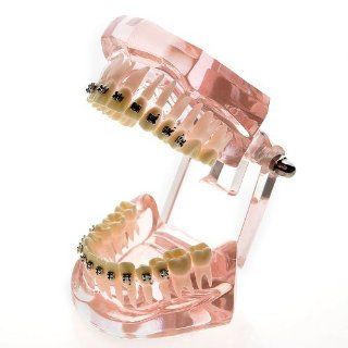 Generic Dental Orthodontics Study Teaching Model with 20 Pcs Metal Orthodontic Brackets: Health & Personal Care