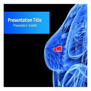 Breast Cancer Powerpoint Template   Breast Cancer Powerpoint (Ppt) Template: Software