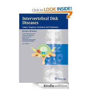 Intervertebral Disk Diseases: Causes, Diagnosis, Treatment and Prophylaxis eBook: Juergen Kraemer: Kindle Store