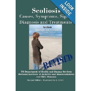 Scoliosis Revised Edition Causes, Symptoms, Signs, Diagnosis and Treatments National Institutes of Health National Institute of Arthritis, S. Smith 9781470051938 Books