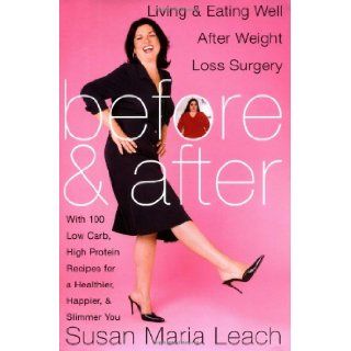 Before and After: Living and Eating Well After Weight Loss Surgery: Susan Maria Leach: 9780060567224: Books