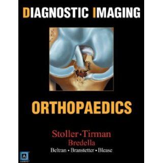 Diagnostic Imaging: Orthopaedics: David Stoller, Phillip Tirman, Miriam Bredella, Robert Branstetter, Simon Blease, David W. Stoller, Phillip F. J. Tirman, Miriam A. Bredella, W. B. Saunders, Salvador Beltran: 9780721629209: Books