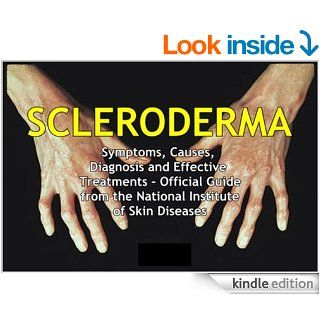 SCLERODERMA: Symptoms, Causes, Diagnosis and Effective Treatments   Official Guide from the National Institute of Skin Diseases eBook: National Institute of Skin Diseases, Department of Health and Human Services' National Institutes of Health (NIH): Ki