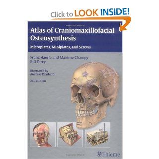 Atlas of Craniomaxillofacial Osteosynthesis Microplates, Miniplates, and Screws (9783131164926) Franz Haerle, Maxime Champy, Bill Terry Books